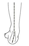 Supination de l'arrière pied Supination de l'arrière pied